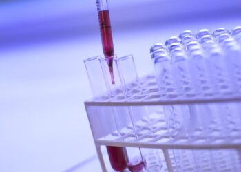 Облыста 88 мың адам арнайы скринингтен өтті