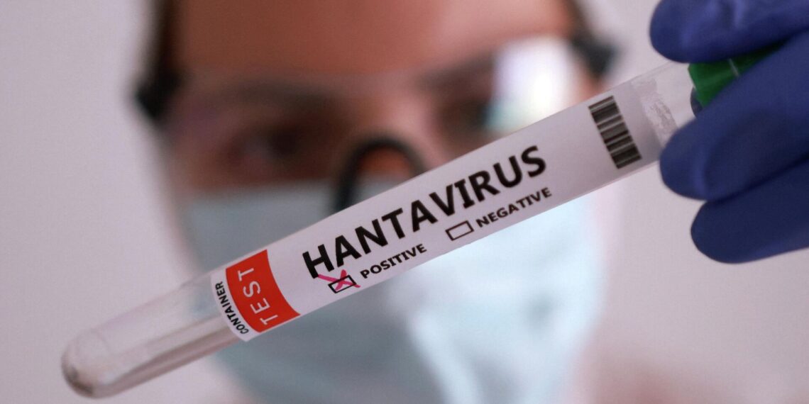 ҚР Денсаулық сақтау министрлігі: Қазақстанға Хантавирустан қауіп жоқ